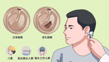 挖耳朵时有多少人担心“挖破鼓膜”?你会怎么预防?